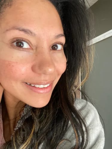 Customer photo review of Nuvee® Wrinkle Patches