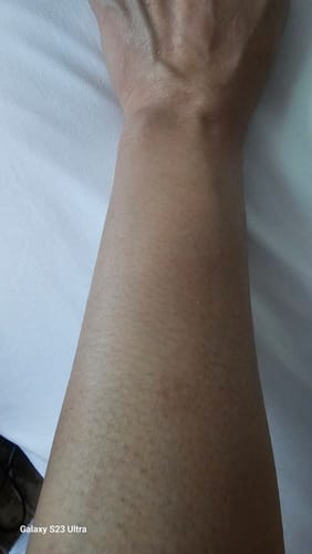 Customer photo review of Iluumi IPL Hair Removal Handset