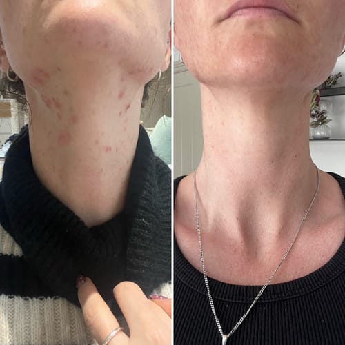 Customer photo review of Radiance Powder