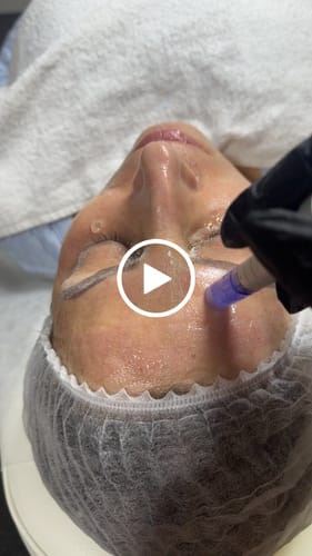 Customer video review of 12 Pin Replacement Cartridges for A6 Ultima 10X