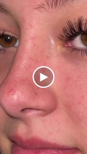 Customer video review of Luelle Deep Cleansing Pore Strips