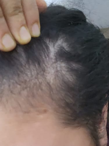 Halema B. review of Collagen 3 Month Supply (750g) image 1 out of 2