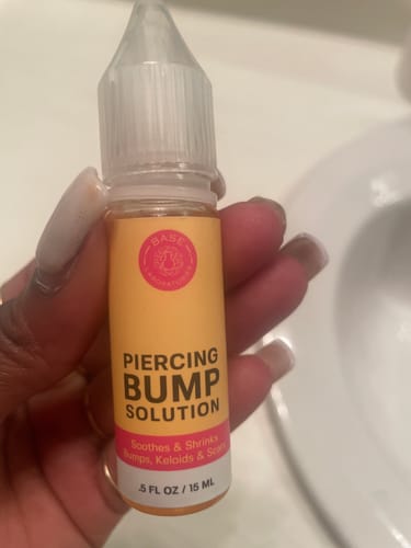 Customer photo review of Piercing Bump Treatment - Bump, Keloid & Scar Relief Oil