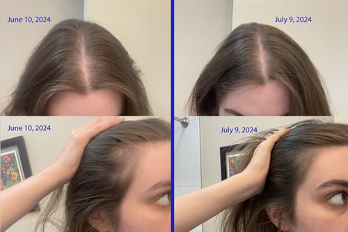 Customer photo review of Pre-Wash Scalp Oil by TR