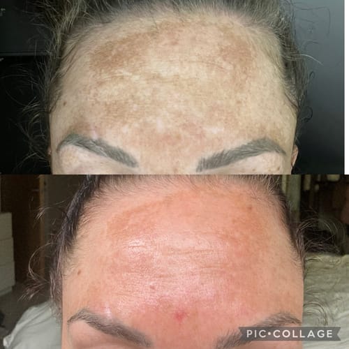 Customer photo review of FULL RESET COLLECTION