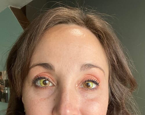 Customer photo review of Cosplay Anime Yellow Prescription Colored Contact Lenses