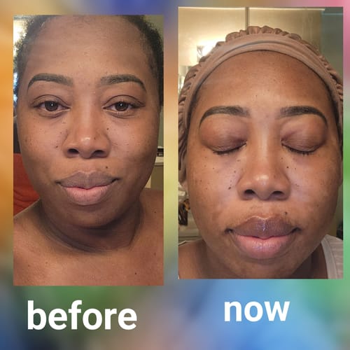 Customer photo review of LIMITED EDITION KIT Jolie’s Mini Full Body & Face Brightening Kit