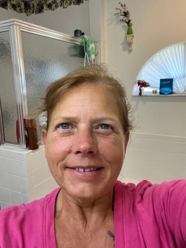 Customer photo review of The Complete System for Mature Women’s Skin