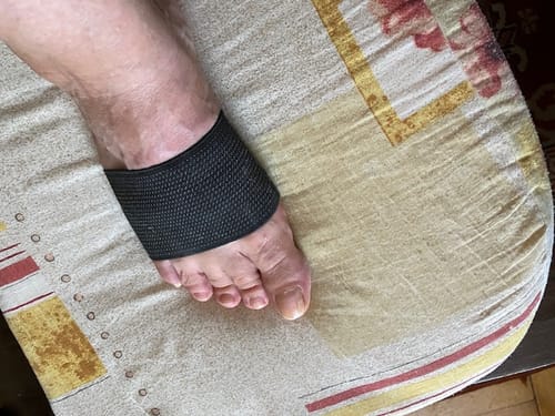 Customer photo review of Réz Nanoszálas Kompressziós Harántemelő Támasz