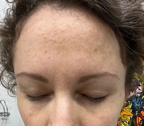 Customer photo review of The Complete System for Mature Women’s Skin