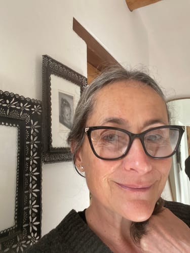 Customer photo review of Buy a Noche Y Dia Vitamin C Serum, Get a Free Limited Edition Cosmetic Bag