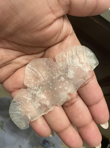 Customer photo review of Luelle Pimple Patches