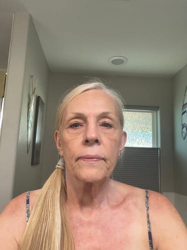 Customer photo review of The Complete System for Mature Women’s Skin