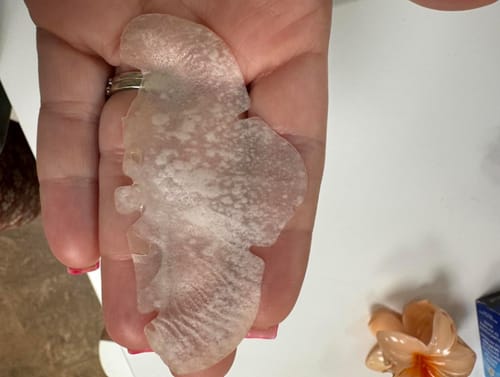 Customer photo review of Luelle Pimple Patches