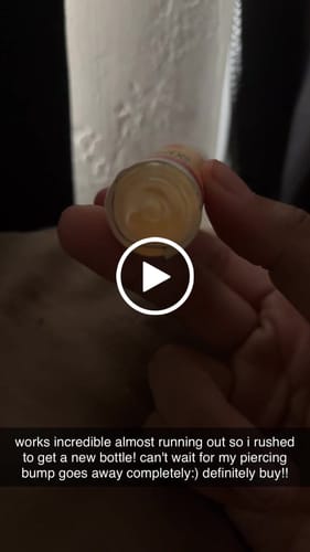 Customer video review of Piercing Bump Treatment - Bump, Keloid & Scar Relief Oil