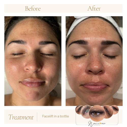 Customer photo review of KrX V Tox Lift Mask