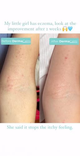 Customer photo review of Rescue Mist Mini (30ml) - Discounted Bulk Purchase