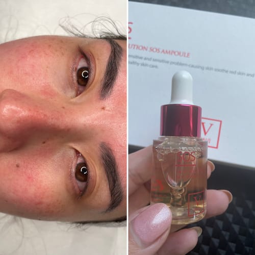 Customer photo review of Fau Skin Solution SOS Ampoule