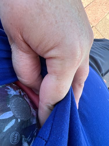 Customer photo review of Freestyle Libre 3