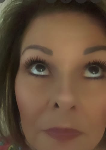 Customer photo review of ETERNAL EYELASH GROWTH SOLUTION