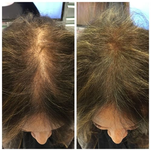Customer photo review of Rosemary & Castor Oil for Hair Growth