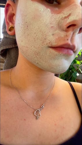 Customer photo review of Diystar™ Deep Cleanse & Bacteria-Fighting Green Tea Mask