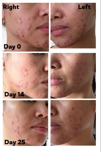 Customer photo review of Radiance Powder