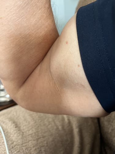 Customer photo review of 1.25 Pound Weight Clips