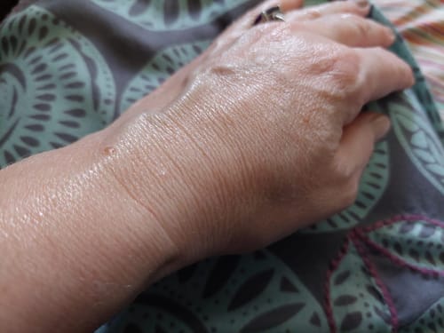 Customer photo review of MooBalm Beef Tallow Cream + FREE E-Book & Tallow Soap