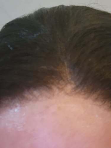Customer photo review of The complete all in one wig install kit