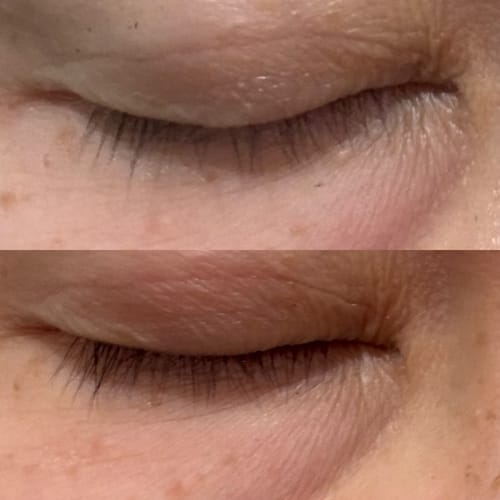 Customer photo review of LASH SERUM