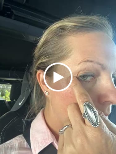 Customer video review of ILLUMINEYE: Roll on Enhanced Castor Blend for Face and Neck