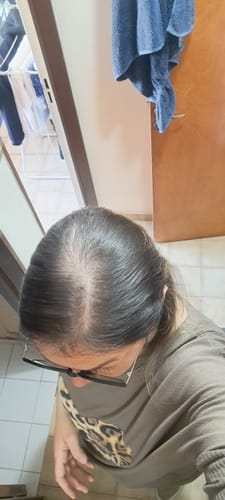 Customer photo review of Match Belleza - Vitaminas Hairfy + Colágeno Hidrolizado