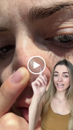 Customer video review of Luelle Deep Cleansing Pore Strips