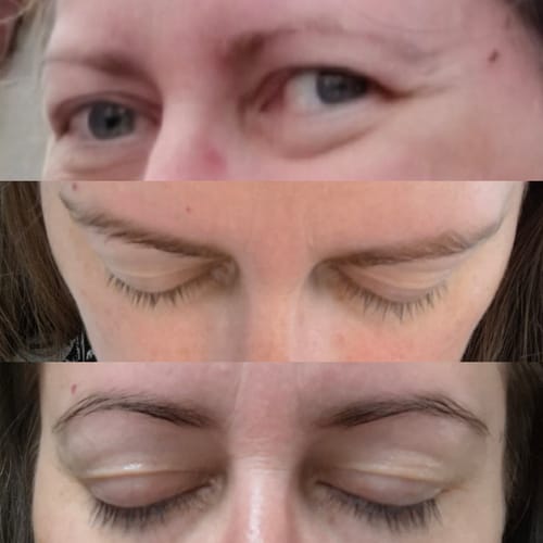 Customer photo review of LASH SERUM