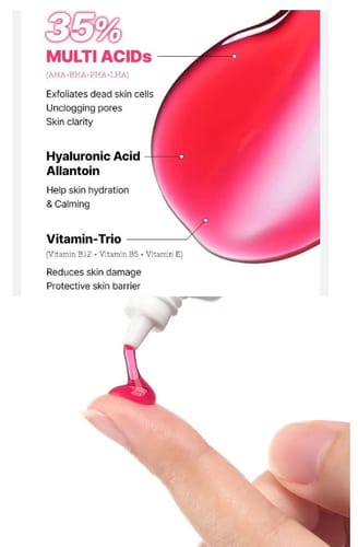 Customer photo review of The AHA BHA PHA LHA 35 Peel