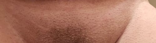 Customer photo review of INIA HAUTE Pro IPL Hair Removal Device