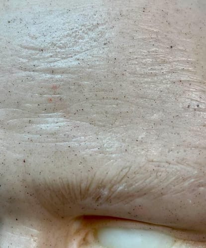 Customer photo review of Effektstudion Texture Roller V - Bumps, reversed pores