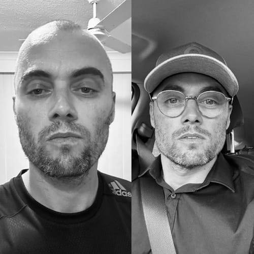 Customer photo review of JAWLINER® 3.0 - Beginner