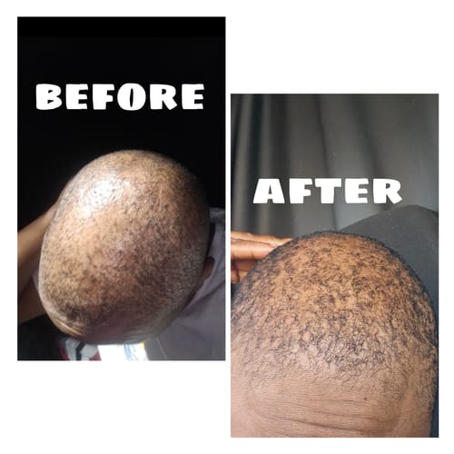 Customer photo review of Ivory Batana Oil & Babassu Oil Leave-In & Deep Conditioning Hair Mask 4 oz