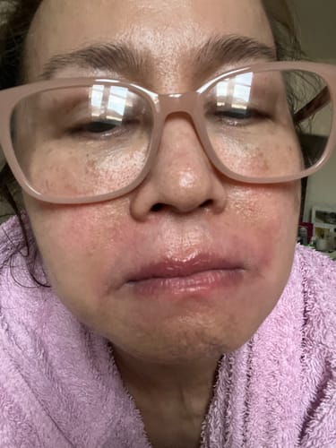 Customer photo review of Multi Strain Biotic