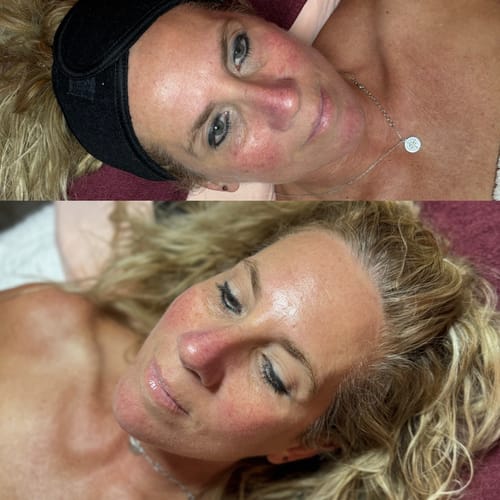 Customer photo review of KrX Inflacure Healing Active