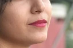 Kinza H. review of ACNE CLARIFYING SERUM - Energetic Skin Therapy for Acne & Scars image 2 out of 2