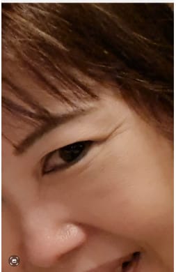 Customer photo review of OUTGLOW - Radiance Tri-Factor™ Jelly