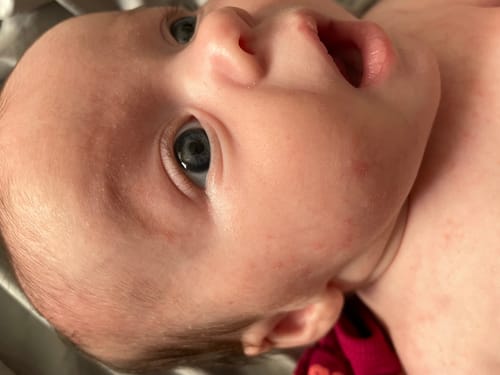 Customer photo review of All Over Ointment Original