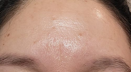 Customer photo review of Glov Micro Infusion System