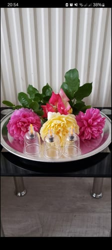 Customer photo review of Premium Cupping Cups - Mixed Sizes from B1 to B6