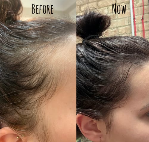 Customer photo review of Hair Growth Oil