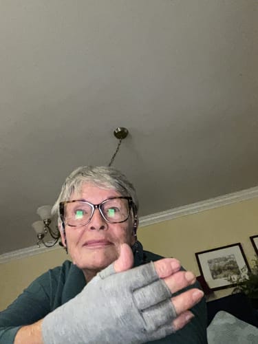 Customer photo review of Premium Onecompress™ Gloves