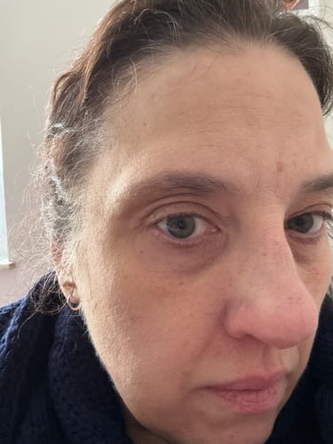 Customer photo review of Glov Micro Infusion System